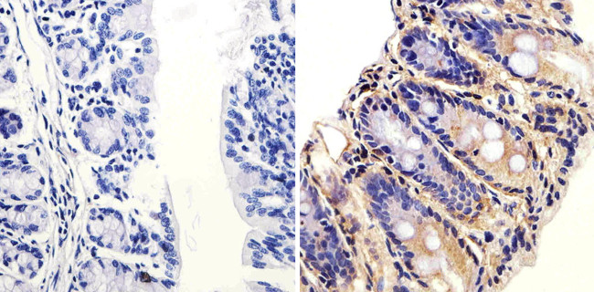 ARF1 Antibody in Immunohistochemistry (Paraffin) (IHC (P))