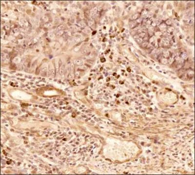 NTHL1 Antibody in Immunohistochemistry (Paraffin) (IHC (P))