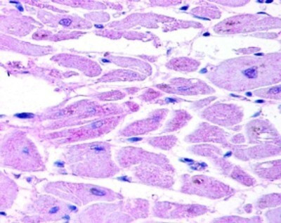 HIF-2 alpha Antibody in Immunohistochemistry (Paraffin) (IHC (P))