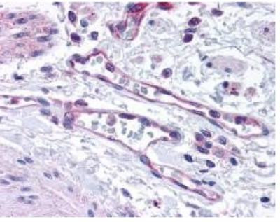 PHD2 Antibody in Immunohistochemistry (Paraffin) (IHC (P))