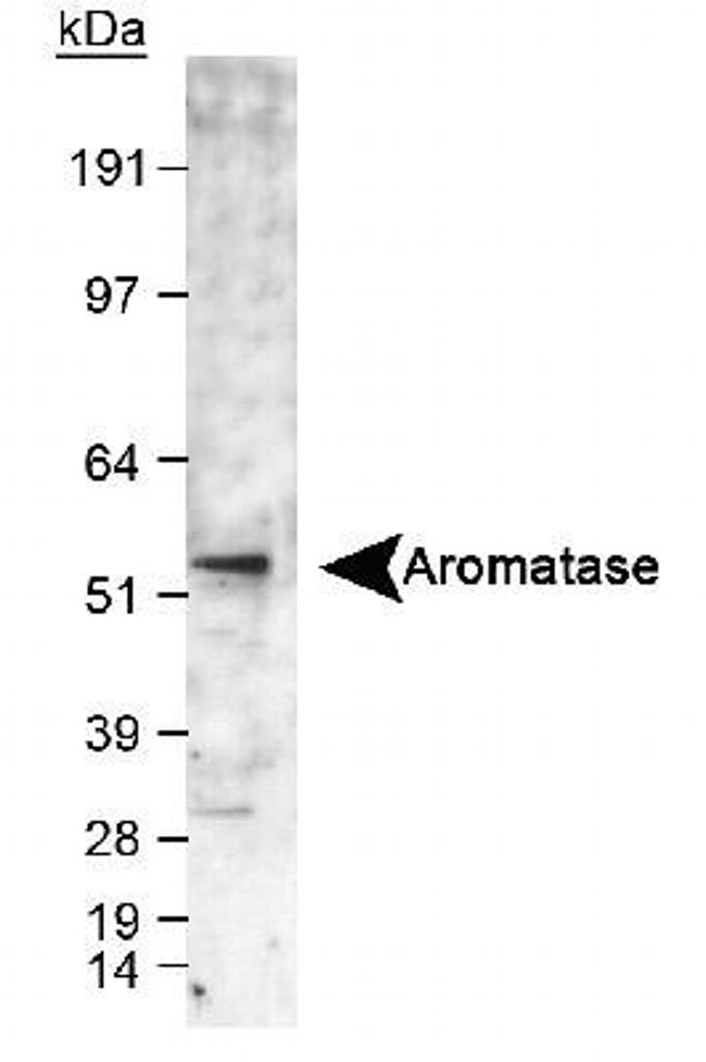 Aromatase Antibody in Western Blot (WB)