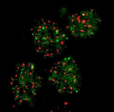 FANCD2 Antibody in Immunocytochemistry (ICC/IF)