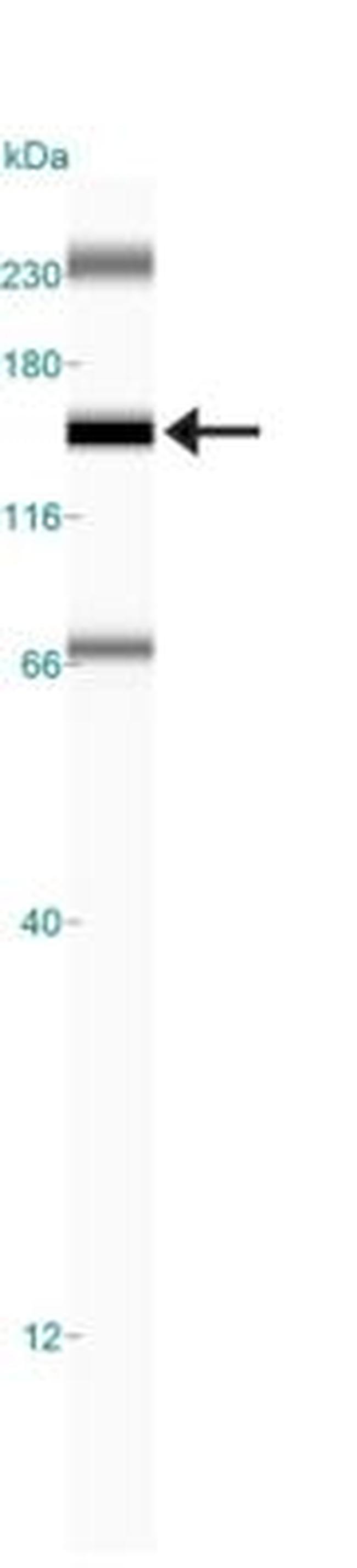 FANCD2 Antibody in Western Blot (WB)