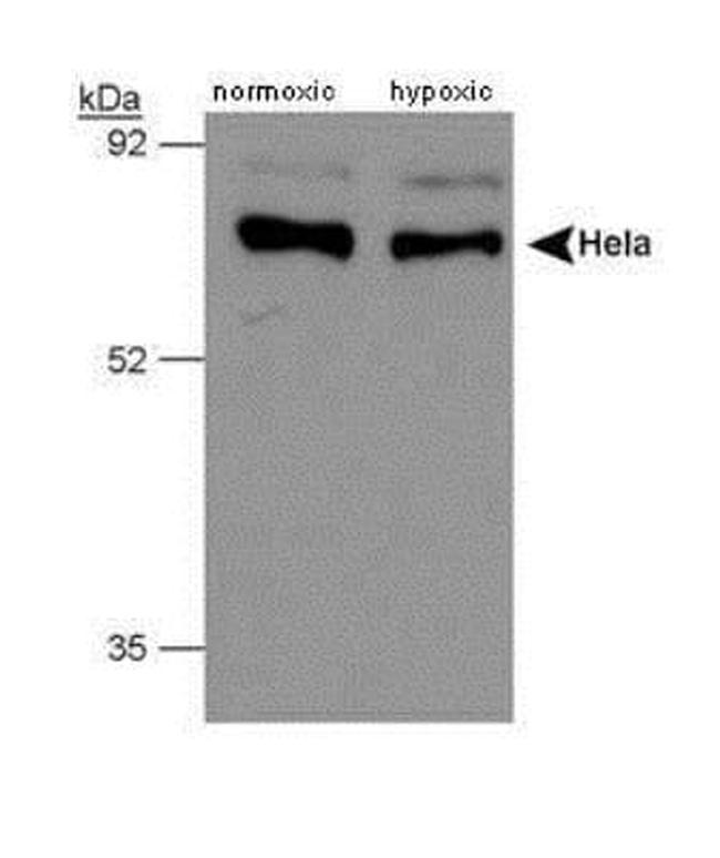 P4HTM Antibody in Western Blot (WB)