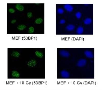 53BP1 Antibody in Immunocytochemistry (ICC/IF)