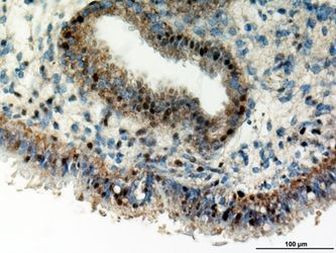 CYR61 Antibody in Immunohistochemistry (Paraffin) (IHC (P))