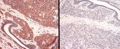 CTR1 Antibody in Immunohistochemistry (Paraffin) (IHC (P))