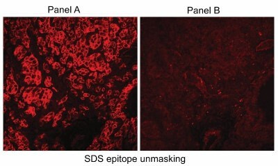 Carbonic Anhydrase IX Antibody in Immunohistochemistry (Paraffin) (IHC (P))