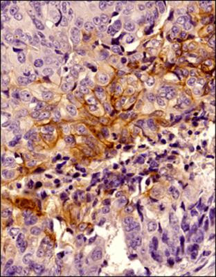 Carbonic Anhydrase IX Antibody in Immunohistochemistry (Paraffin) (IHC (P))