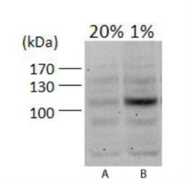 HIF1A Antibody in Western Blot (WB)