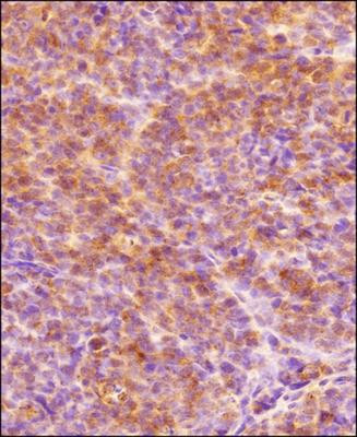 HIF1A Antibody in Immunohistochemistry (Paraffin) (IHC (P))