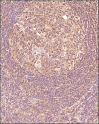 CTGF Antibody in Immunohistochemistry (Paraffin) (IHC (P))