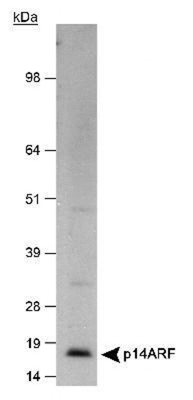 p14ARF Antibody in Western Blot (WB)