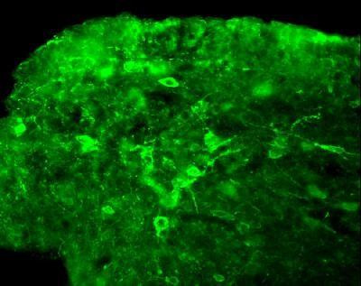 NKB Antibody in Immunohistochemistry (Paraffin) (IHC (P))