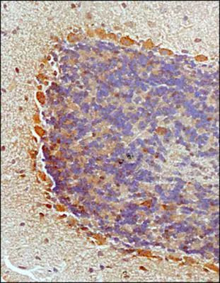 NKB Antibody in Immunohistochemistry (Paraffin) (IHC (P))