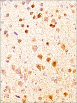 NKB Antibody in Immunohistochemistry (Paraffin) (IHC (P))