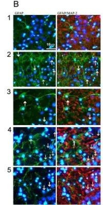 MAP2 Antibody in Immunocytochemistry (ICC/IF)