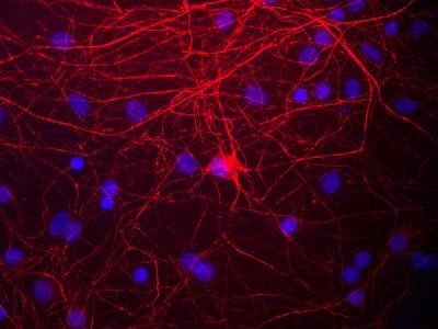 NEFM Antibody in Immunocytochemistry (ICC/IF)