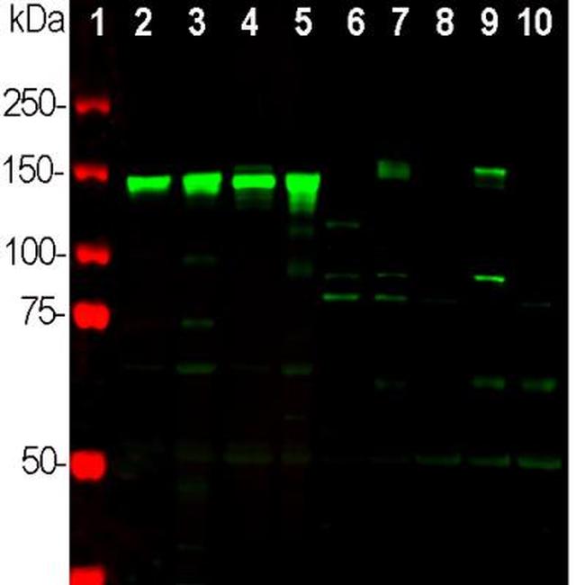 NEFM Antibody in Western Blot (WB)