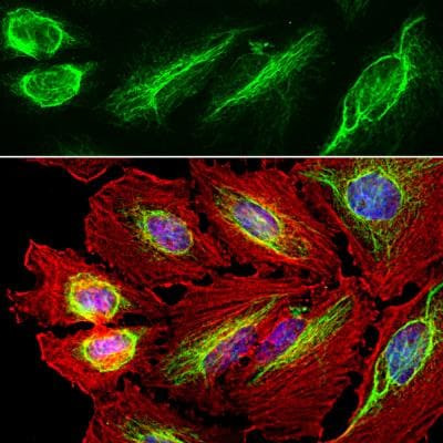 Vimentin Antibody in Immunocytochemistry (ICC/IF)