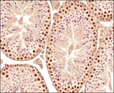 SCP3 Antibody in Immunohistochemistry (Paraffin) (IHC (P))