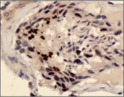 SCP3 Antibody in Immunohistochemistry (Paraffin) (IHC (P))