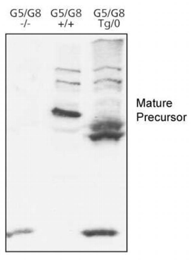 ABCG8 Antibody in Western Blot (WB)