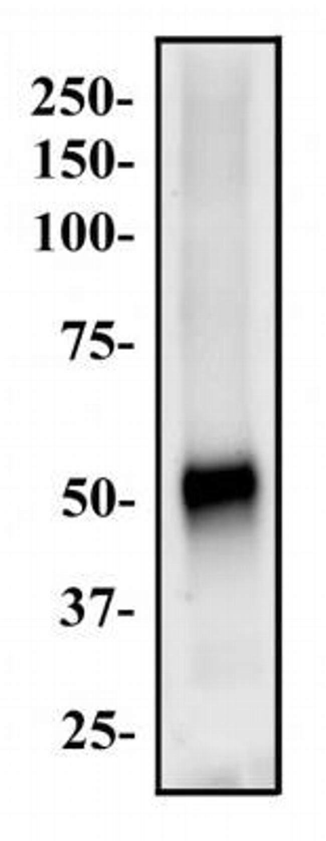 ABCG8 Antibody in Western Blot (WB)