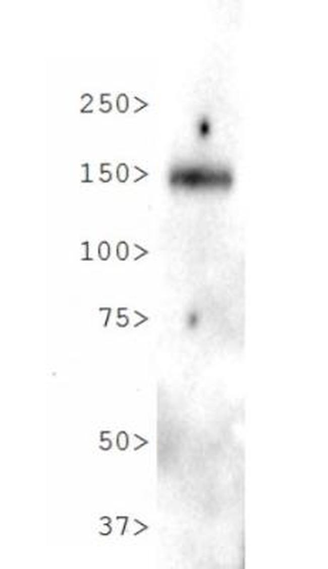 NPC1L1 Antibody in Western Blot (WB)