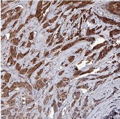 Survivin Antibody in Immunohistochemistry (Paraffin) (IHC (P))