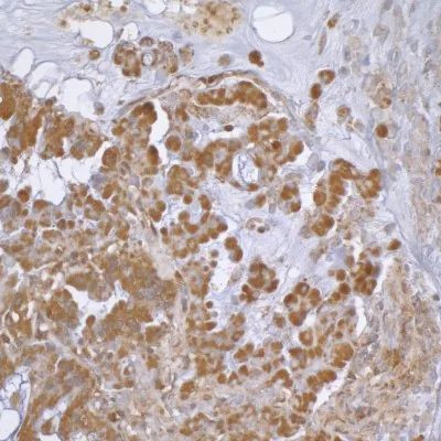 beta Actin Antibody in Immunohistochemistry (Paraffin) (IHC (P))