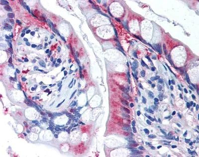 SLC7A11 Antibody in Immunohistochemistry (Paraffin) (IHC (P))