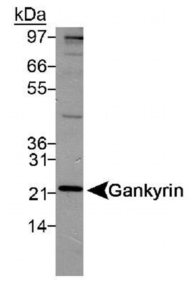 PSMD10 Antibody in Western Blot (WB)