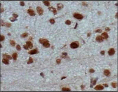 JARID2 Antibody in Immunohistochemistry (Paraffin) (IHC (P))