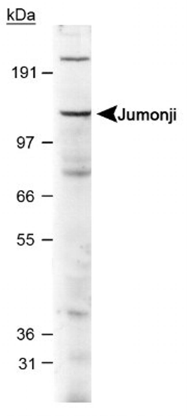 JARID2 Antibody in Western Blot (WB)