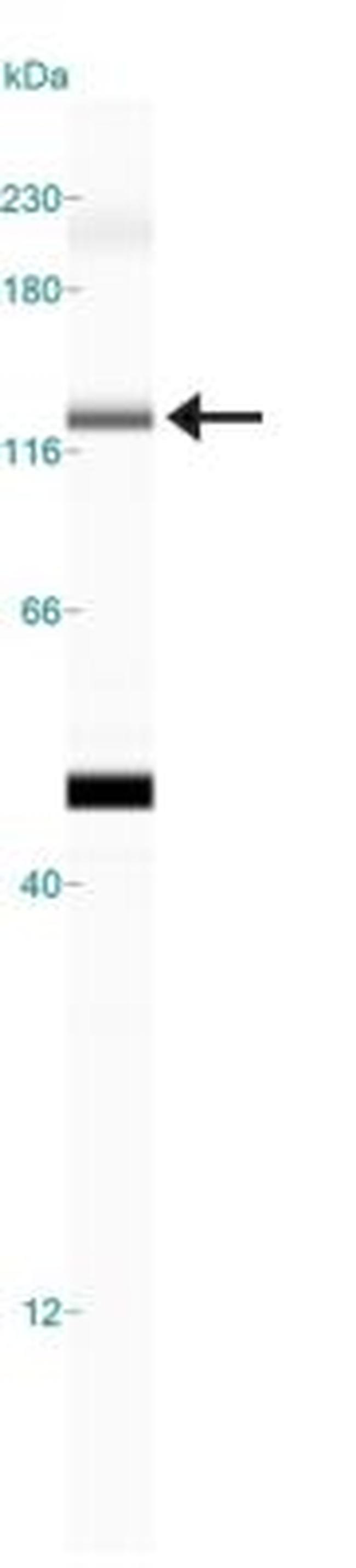 JARID2 Antibody in Western Blot (WB)