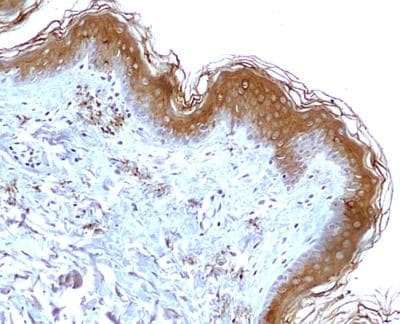 Mitofilin Antibody in Immunohistochemistry (Paraffin) (IHC (P))