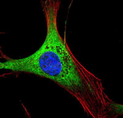 Calreticulin Antibody in Immunocytochemistry (ICC/IF)