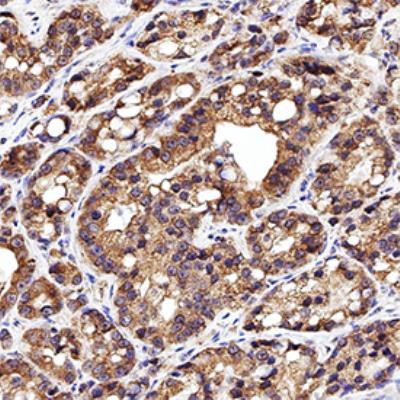 Calreticulin Antibody in Immunohistochemistry (Paraffin) (IHC (P))