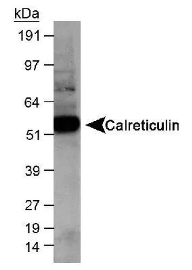 Calreticulin Antibody in Western Blot (WB)