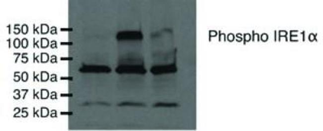 Phospho-IRE1 alpha (Ser724) Antibody in Western Blot (WB)