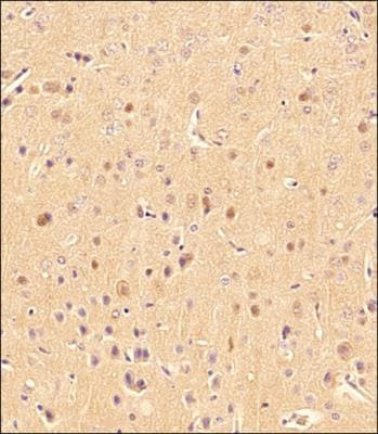 LC3B Antibody in Immunohistochemistry (Paraffin) (IHC (P))