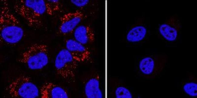 LC3B Antibody in Western Blot (WB)