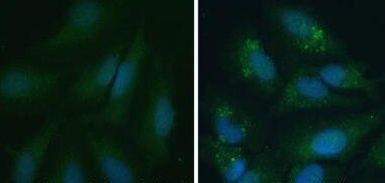 LC3A/LC3B Antibody in Immunocytochemistry (ICC/IF)