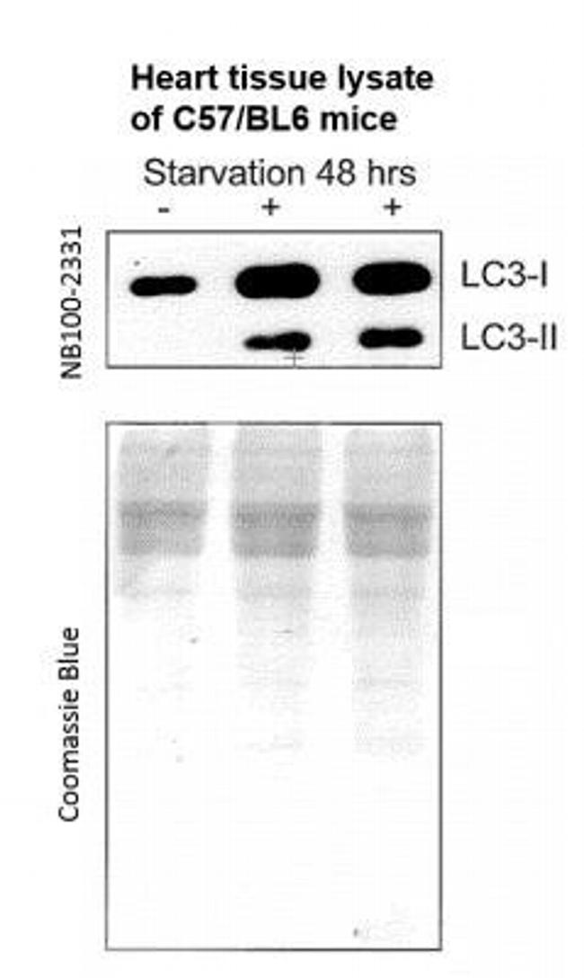 LC3A/LC3B Antibody in Western Blot (WB)