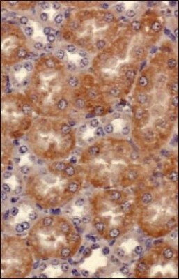 SEMA3B Antibody in Immunohistochemistry (Paraffin) (IHC (P))