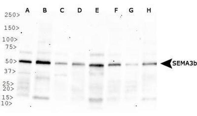 SEMA3B Antibody in Western Blot (WB)