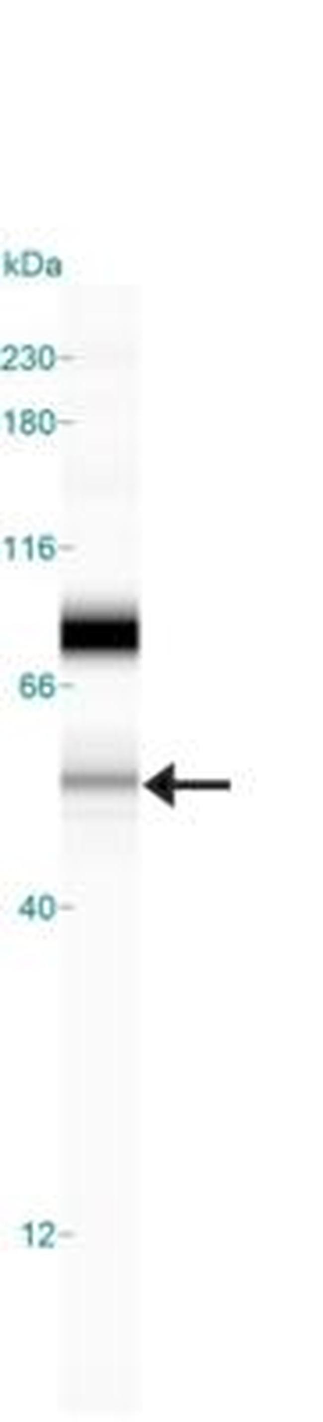 SEMA3B Antibody in Western Blot (WB)