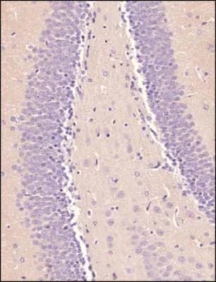 OCT4 Antibody in Immunohistochemistry (Paraffin) (IHC (P))