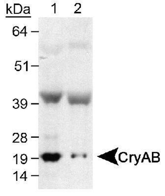 CRYAB Antibody in Western Blot (WB)